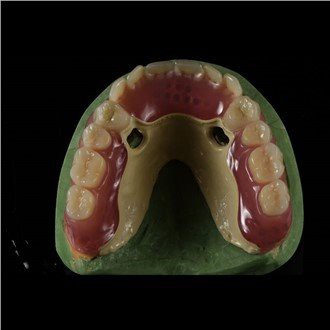 زیر چشمی چارچوب دندانه دار
