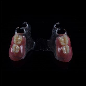 پروتز جزئی اکریلیک متحرک