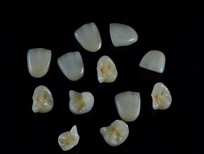 نحوه انتخاب بهترین چسب دندان برای روکش: آخرین راهنما